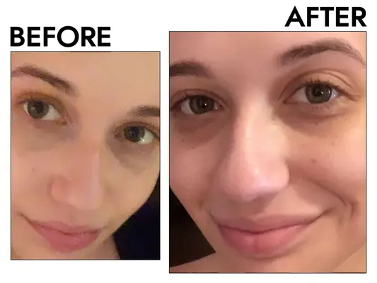 The INKEY List SuperSolutions 1% Retinol Serum