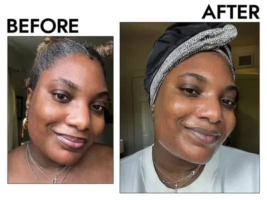 Before and after photos showing the effects of using Neutrogena Hydro Boost Hyaluronic Acid Hydrating Water Gel