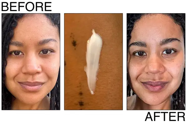 A person before and after using the SkinCeuticals Triple Lipid Restore 2:4:2 cream