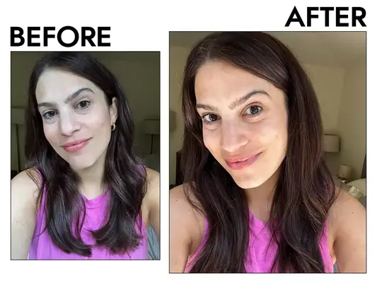 Before and after photos show the effects of using CeraVe Moisturizing Cream for Normal to Dry Skin with Ceramides