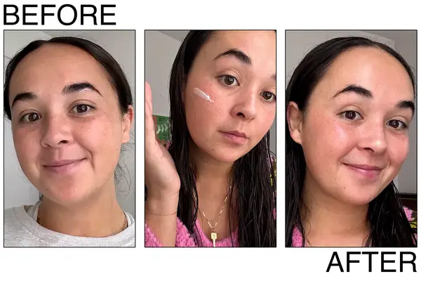 A person before, during, and after using the InnBeauty Project Extreme Cream on their face