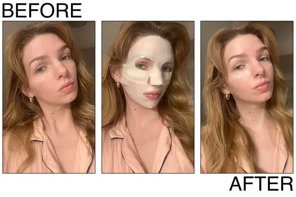 U Beauty The BARRIER Bioactive Treatment