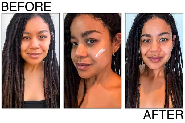 Side-by-side view of a woman, labeled before and after, showing skin appearance changes