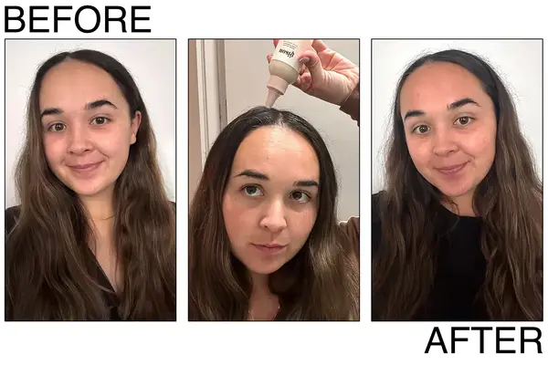 Moroccanoil Dry Scalp Treatment