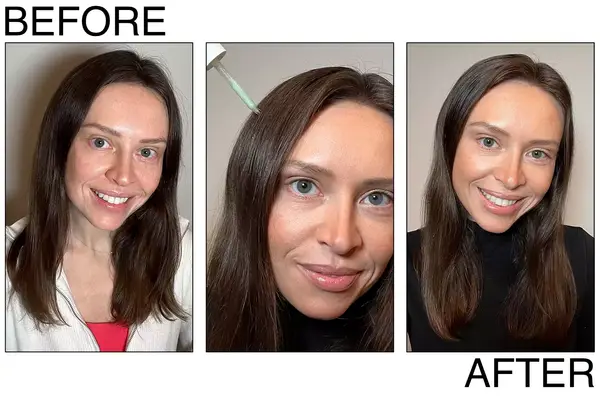 Living Proof Scalp Care Dry Scalp Treatment