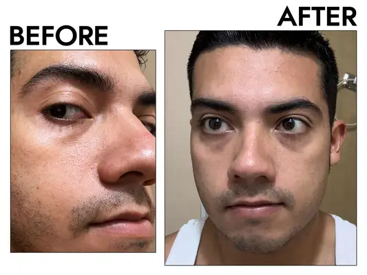 Tata Harper Clarifying Moisturizer