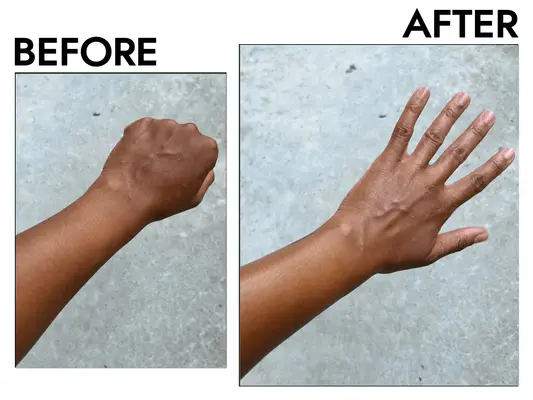 Before and after photo of hand 