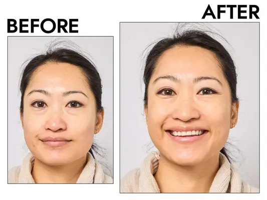 Glossier Perfecting Skin Tint