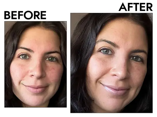 A before and after photo showing the effects of wearing PÃR 4-in-1 Tinted Moisturizer Broad Spectrum SPF 20