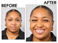 A before and after photo showing the effects of using PÃR 4-in-1 Tinted Moisturizer Broad Spectrum SPF 20