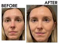 A before and after photo showing the effects of wearing beautyblender 12-Hour Always on Radiant Skin Tint with Hyaluronic Acid & Niacinamide