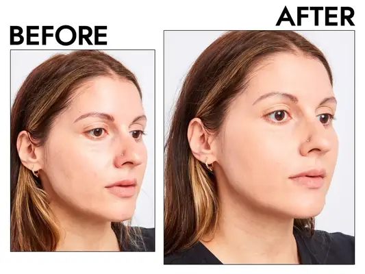 Photos of person’s face before and after using e.l.f. Camo Powder Foundation